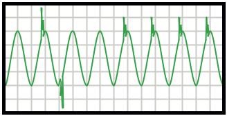 sobretensiones-transitorias-calidad-de-energia